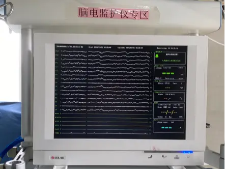 心脏q波异常_心电图q波异常能恢复吗_心脏异常q波